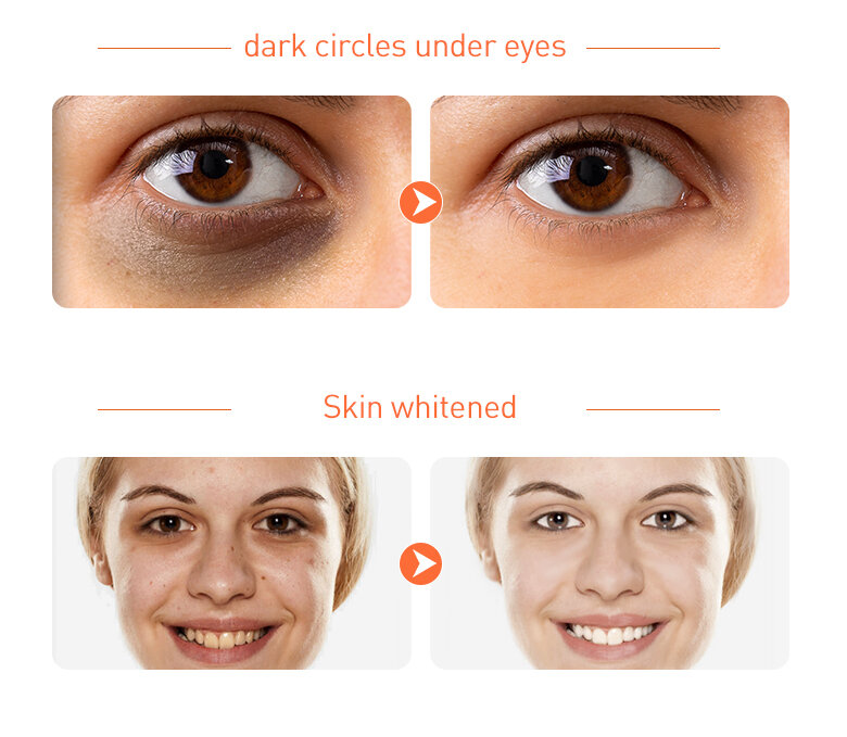 1Set/5PCS Vitamin C Bleaching Creme Hautpflege Kits Reinigung Erhellen Moisturizr für Dunkle Haut Emulsion Gesichts hautpflege Produkte