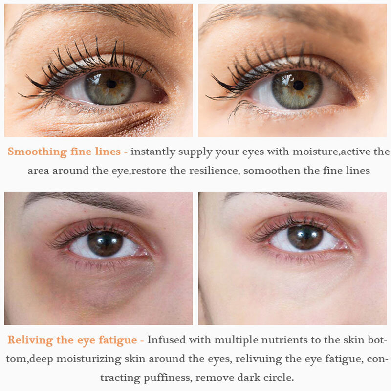 Vitamin C Whitening ครีมทาใต้ตาลบตาคล้ำตาถุง Anti-Wrinkle กระจ่างใส Moisturizer Serum Eye Care สุขภาพความงาม20ml
