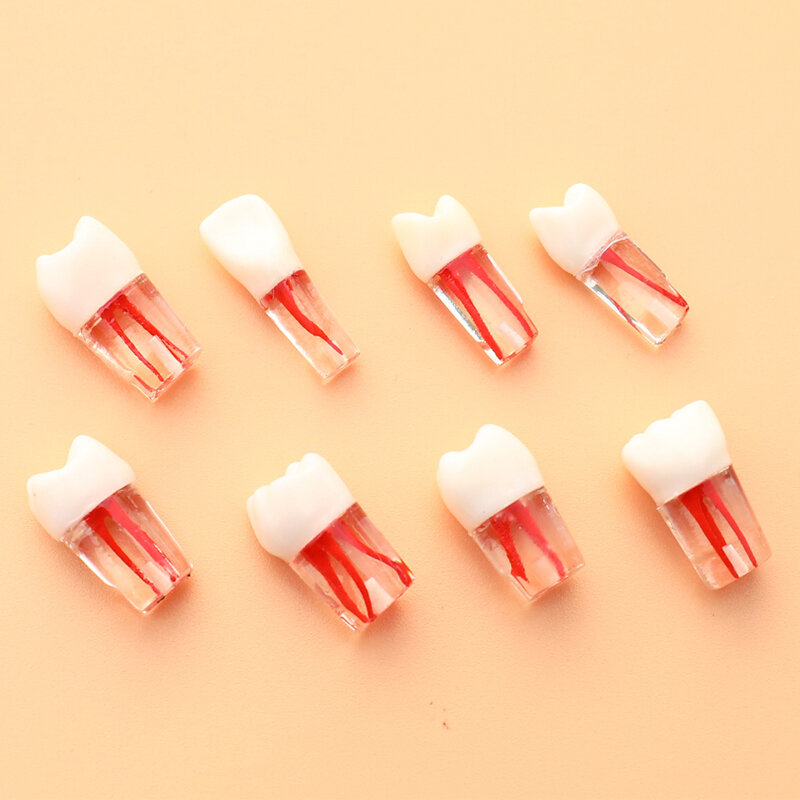 1 قطعة نموذج الأسنان الراتنج الأسنان اللبية نموذج الأسنان مع قناة الجذر الملونة وممارسة اللب