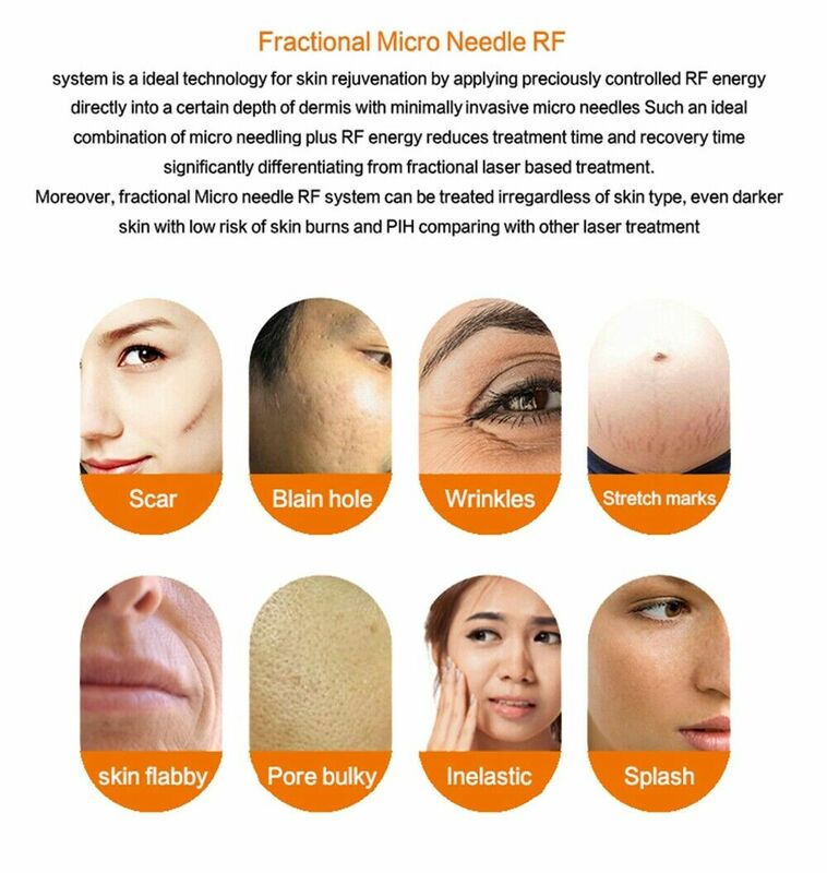 Tubo per Microneedle RF Cartridge Machine Face Skin Lifting cicatrici da Acne rimozione smagliature sostituzione monouso Connect