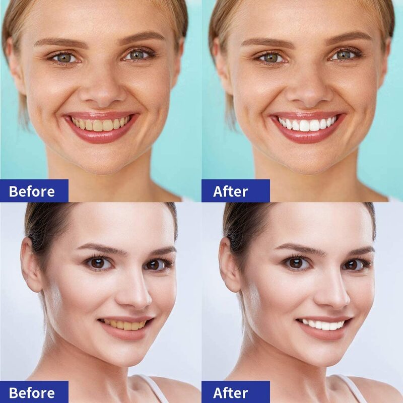 5D Teeth Whitening Strips Removes Smoke Tea Coffee Stains Dental Bleaching Gel Veneers Dentist Oral Hygiene Care Beauty Health