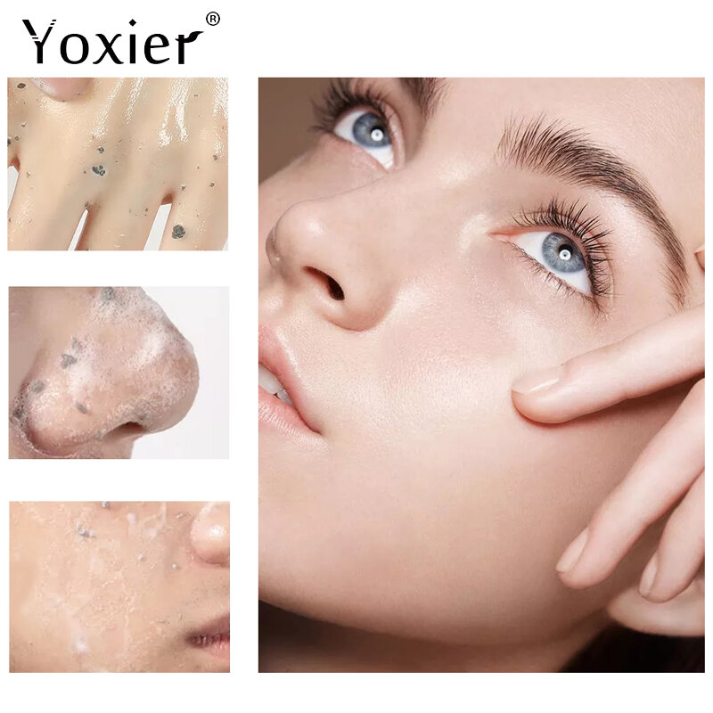 Gezicht Exfoliërende Gel Hydraterende Fleuren Skin Colour Verwijderen Overtollige Onzuiverheden Mee-eter Acne Diepe Reiniging Olie Controle Voeden