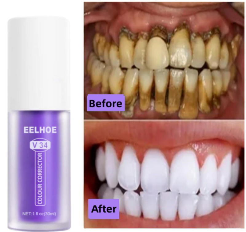 ฟัน V34ยาสีฟันสูตรฟันขาวสีควันลบคราบฟันแก้ไขทำความสะอาดปากซ่อมแซมลมหายใจสดลดสีเหลือง