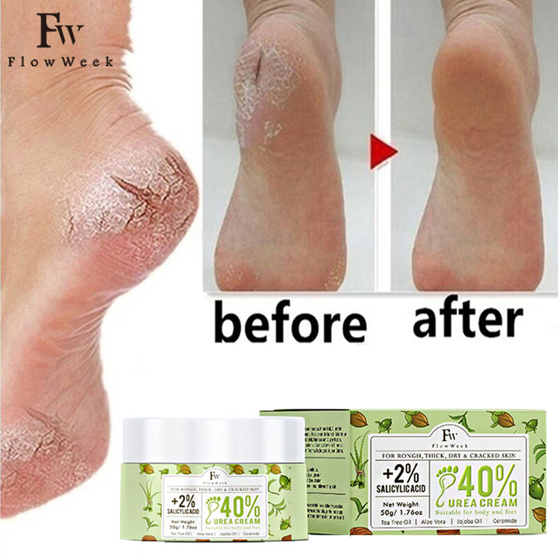 Flow -du-- Crème hydratante pour les pieds à la vitamine E, soin de la peau, 40% d'urée