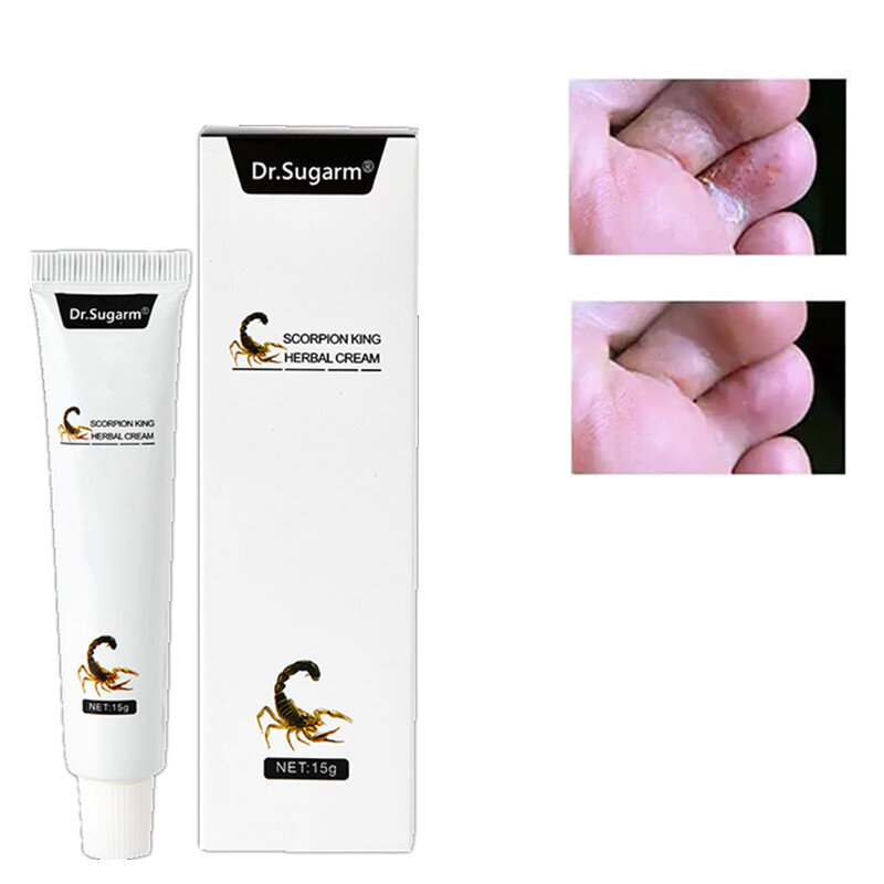 Dr.Sugarm – crème de soins pour la peau, pommade Anti-démangeaison à base d'herbes chinoises, pour la dermite due au rhume, 15g