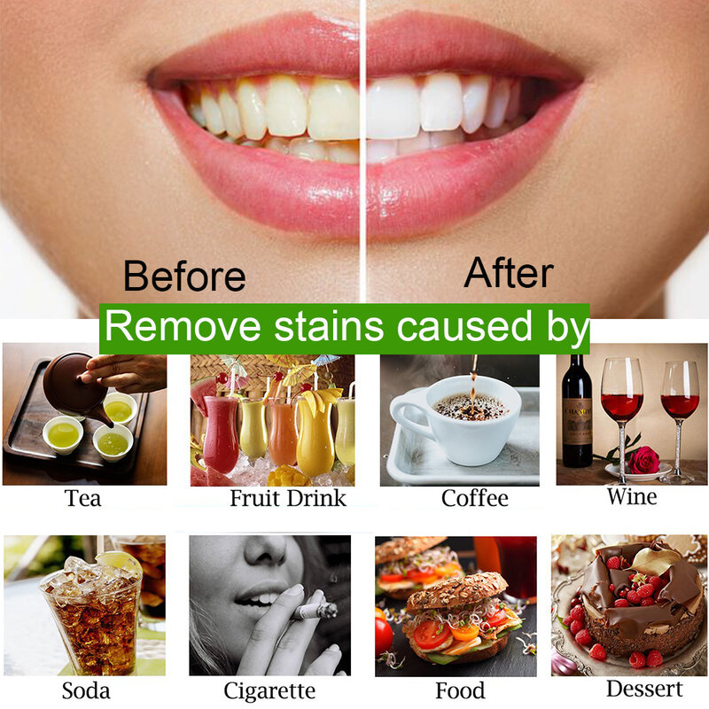 Usuwanie plam z płytki nazębnej higiena jamy ustnej esencja pasta do zębów zestaw szczoteczek do zębów pielęgnacja zębów wybielanie zębów