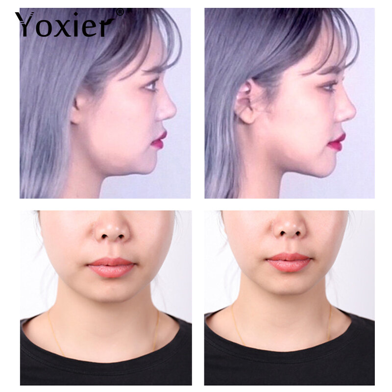 Yoxier يشد رقيقة الوجه ملصقا الخامس الوجه التصحيح مستحضرات التجميل غير مرئية الشريط تشديد مزدوج الذقن رفع مترهل الجلد قناع الوجه رفع