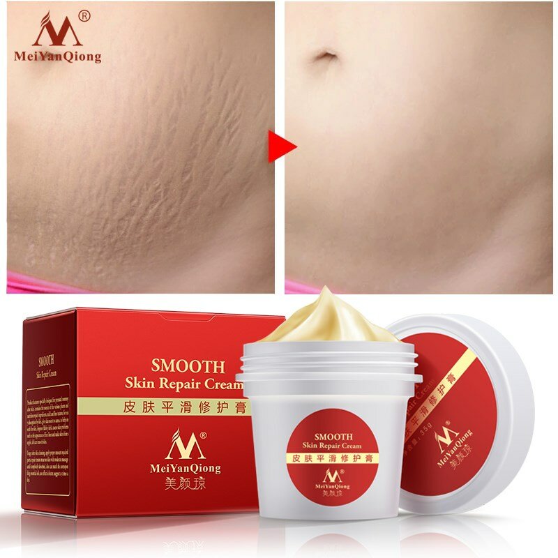 Pregnancy cream Removes Maternal Skin Repair Body Cream Removes Postpartum Scar Care Gentle Moisturizing Smooth skin