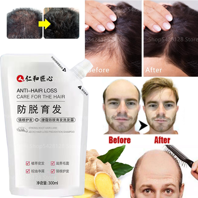 สมุนไพร Anti-Hair Growth Shampoo แชมพูผมร่วง Growth Hair Growth Solid Development Hair Liquid