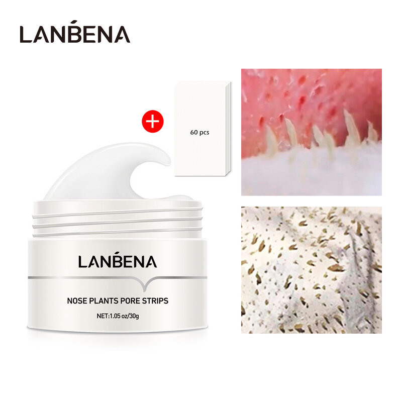 LANBENA – dissolvant de points noirs, masque de nez, bande de pores, masque noir, Peeling, traitement de l'acné, nettoyage en profondeur, rétrécissement des pores, soins du visage