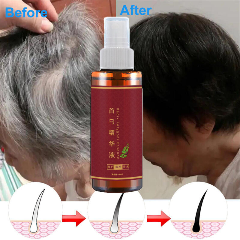 3PCS Gray White Hair Treatment Spray White To Black Natural Darkening Color Repair Shampoo Anti Loss Hair Care Essence Women Men