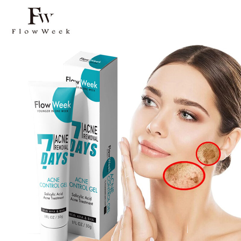 Semana de fluxo acne controle gel 30ml ácido hialurônico acne clareamento enrugamento clareamento facial delicado clareamento beleza cosméticos