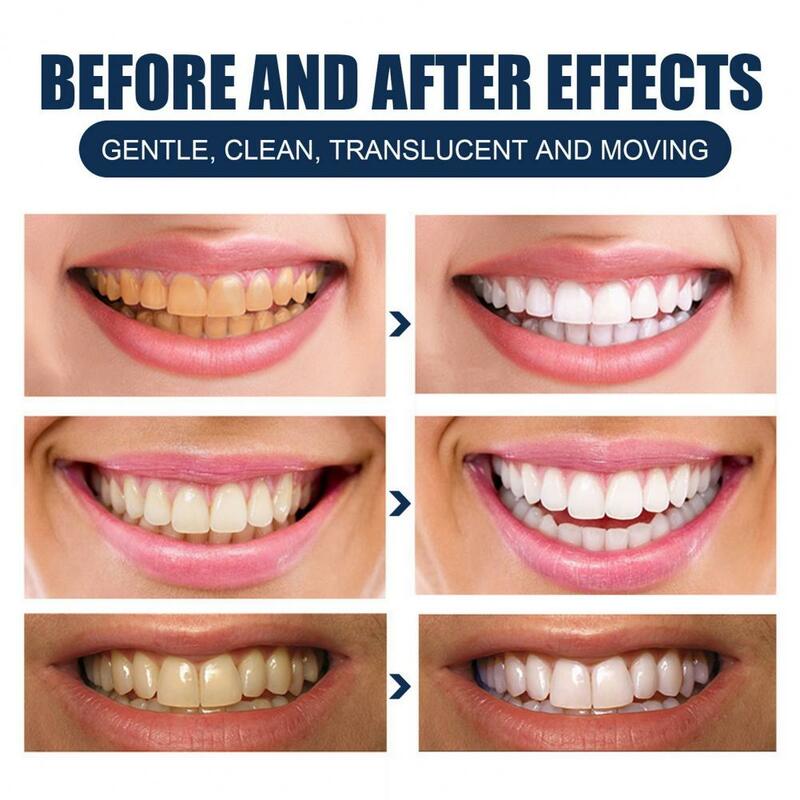90ml ujawnia jaśniejszy uśmiech, równoważy ton zębów, ukrywa plamy i poprawia ogólną jasność.
