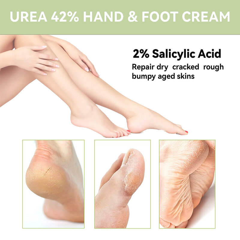 Aliran minggu krim Urea 40% Plus asam salisilat 2% penghilang kalus krim tangan krim kaki untuk perawatan perbaikan tangan kaki retak kering