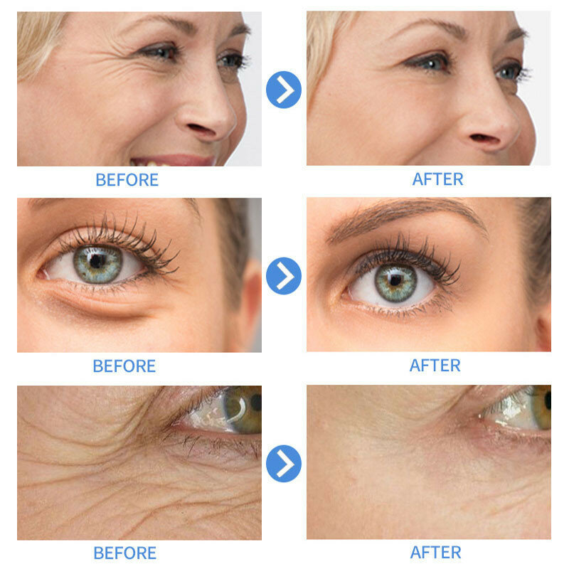 Retinol Anti Aging ลบริ้วรอยเซรั่มยก Brighten Face Skin Fade Eye Fine เส้น Moisturizing Firming Facial Essence 30Ml