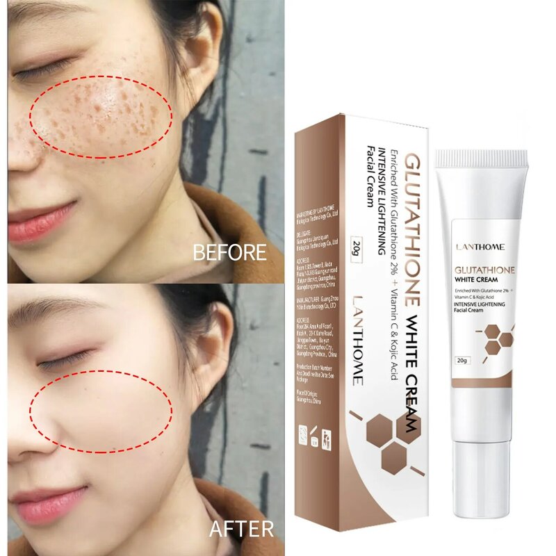 Whitening Spot Cream Freckles Removal Dark Spot Remover Lighten Spots Melanin Moisturizing Glutathione Face Cream Skin Care