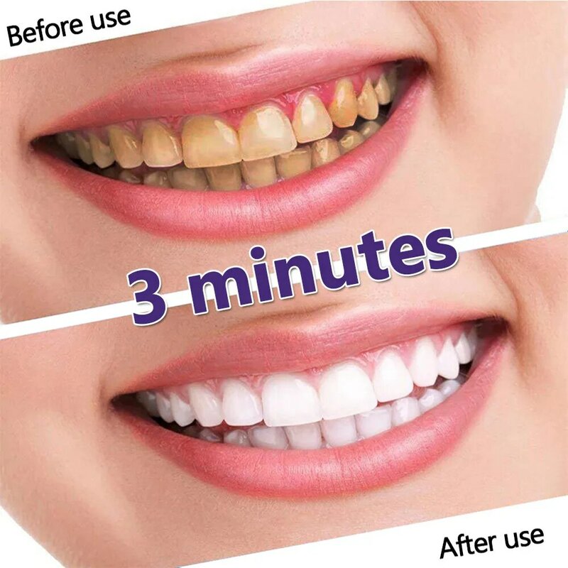 V34 Tooth Colour Whitening Toothpaste Smoke Stain Remove Teeth Corrector Oral Cleaning Repair Fresh Breath Reduce Yellowing