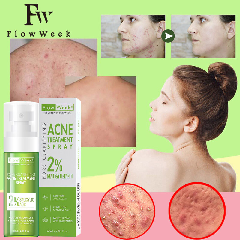 Back and Body Acne Tratamento Spray, Flow Week, Remoção de Acne, Orgânico, Skin Care