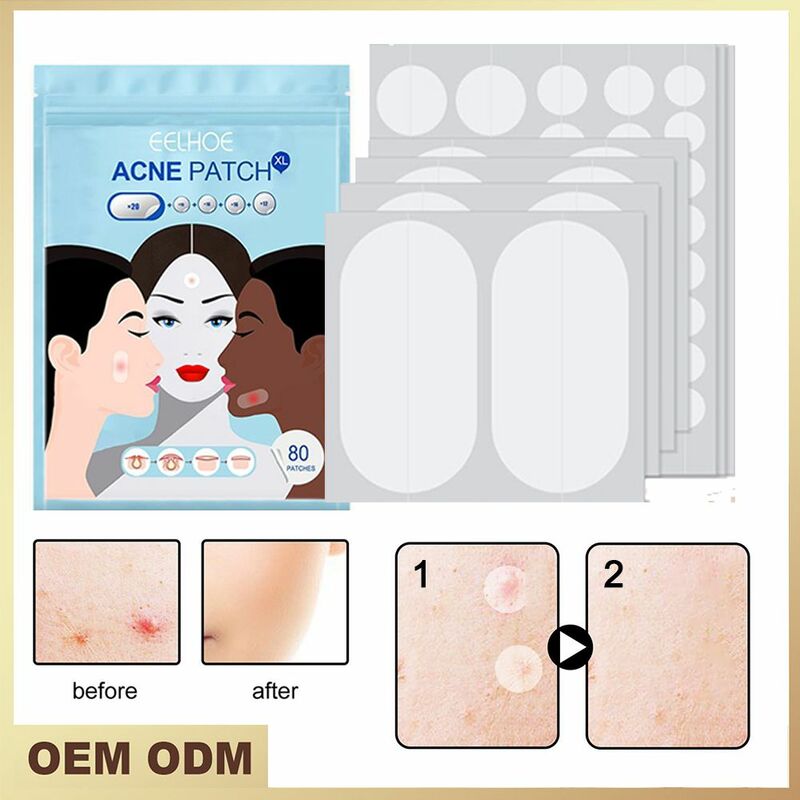 80 pces manchas de acne manchas adesivos de tratamento de manchas de acne mancha mancha mancha manchas máscara facial hidropóide pele tag removedor de cravo
