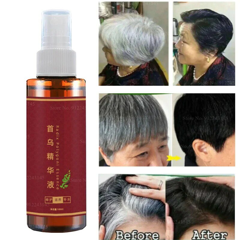 Shouwu Essence Oil Control Shampoo a base di erbe idratante crescita dei capelli capelli neri perdita di capelli Shampoo balsamo organico