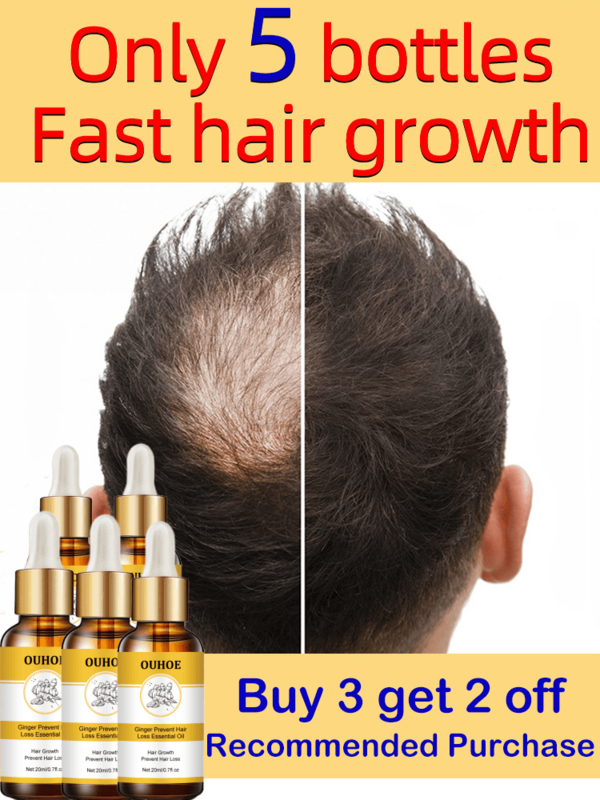 قوي نمو الشعر المصل مكافحة تساقط الشعر سريع نمو الشعر الزهمي الثعلبة شعري حتى علاج بصيلات الشعر الرعاية الصحية