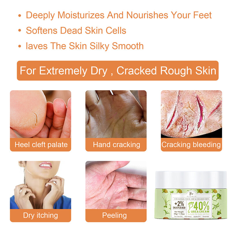 Flow Week vitamina E Urea crema per la cura della pelle Urea 40% crema per i piedi rimozione del callo idratante per i piedi mais Callus rimozione della pelle morta