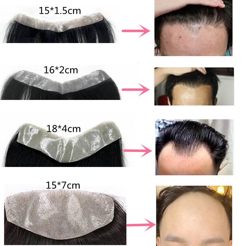 Halo Lady Men 'S Dahi Frontal Human Hair Piece V Loop Front Hairline dengan Tape untuk Men Non-remy Real Hair Replacement System