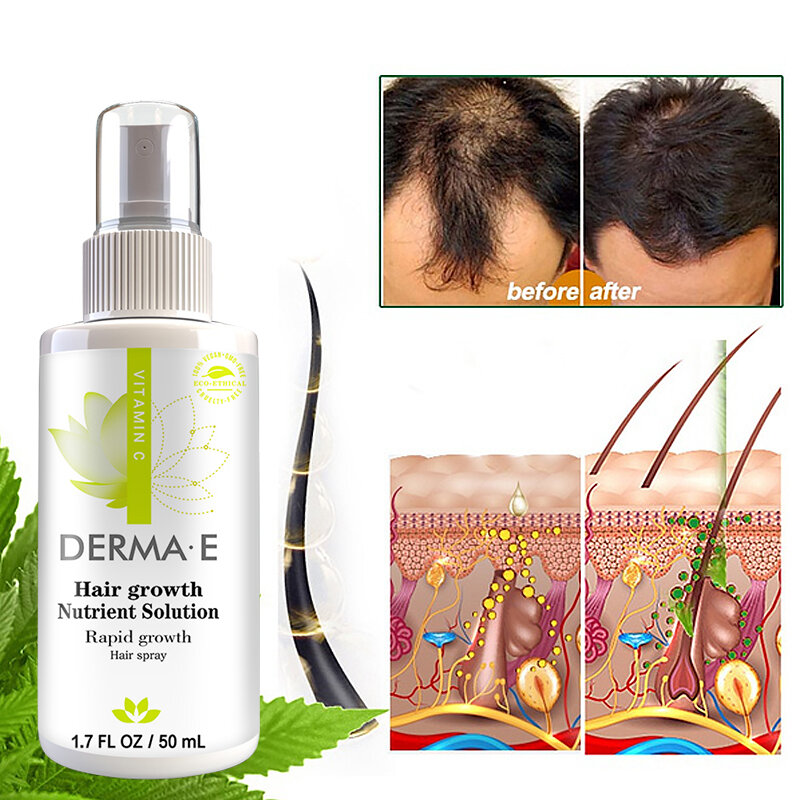 Aceite de crecimiento del cabello para hombres y mujeres, productos de crecimiento rápido del cabello, cuidado del cuero cabelludo, previene la pérdida de cabello seco y adelgazamiento, cuidado de belleza