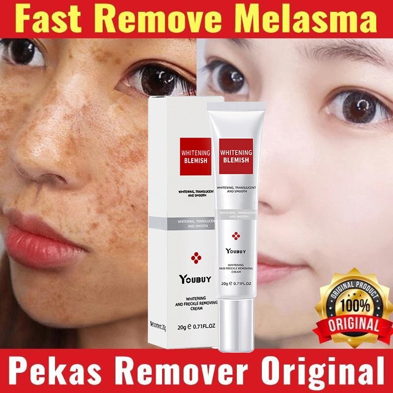 Crema sbiancante lentiggine Melasma Cream Pekas Remover rimozione macchie scure illumina la pelle crema sbiancante Anti-età per la pelle