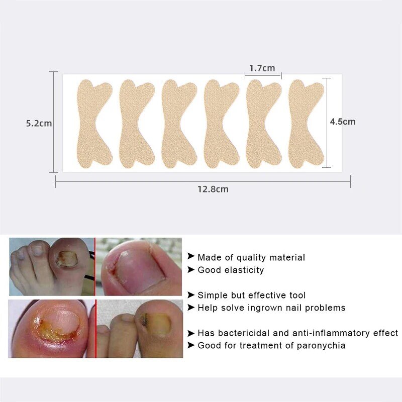 Pexmen 16 pces corretor de unhas do pé remendo encravado correção de unhas adesivos cola-livre saúde toenail tratamento ferramenta de cuidados com os pés