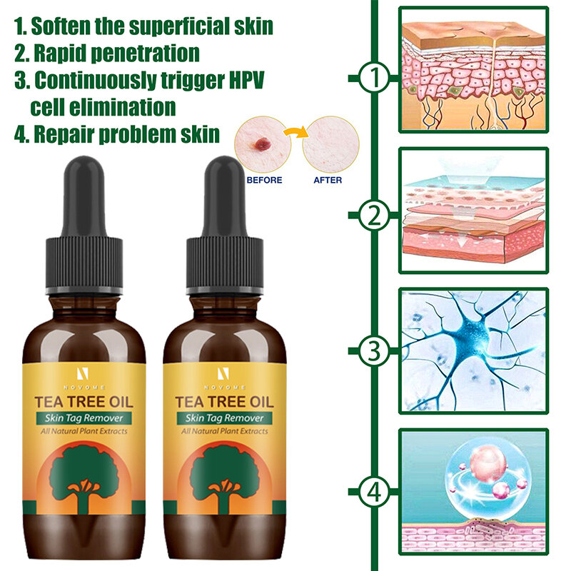 Soluzioni di Tag organici siero indolore pelle di talpa siero per la rimozione delle macchie scure lentiggine viso rimozione dell'etichetta della verruca olio essenziale