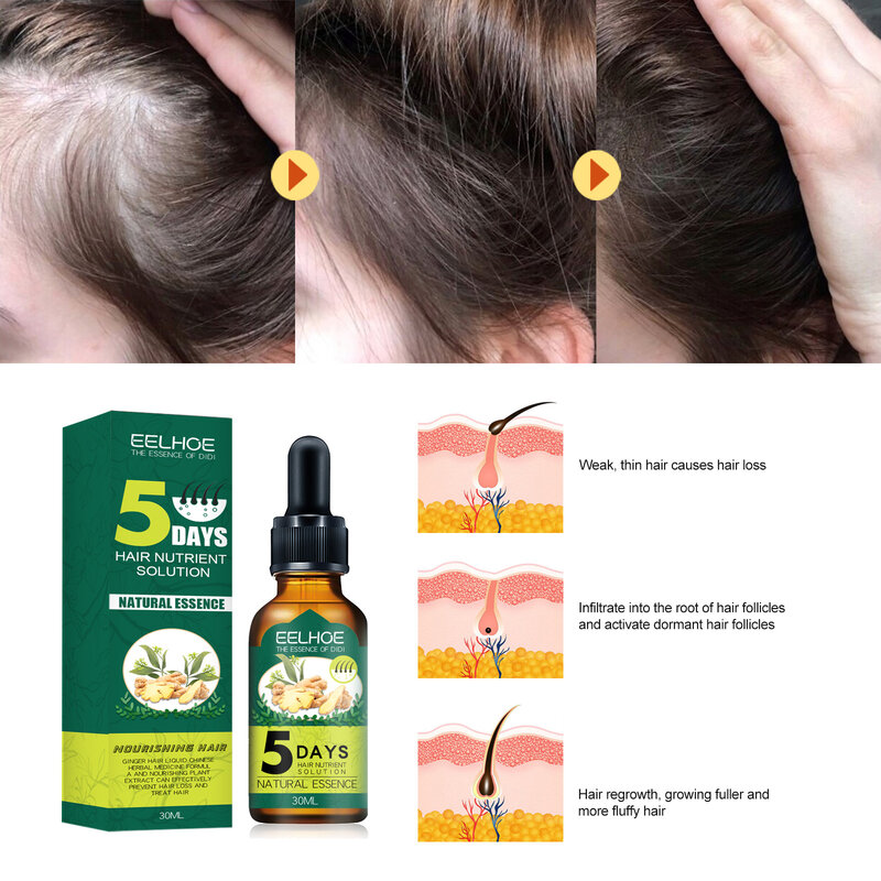 Ginger Hair Growth nutrition szybko rosnący olejek eteryczny do włosów zapobieganie utrata włosów olej leczenie skóry głowy olej dla mężczyzn kobiety pielęgnacja włosów