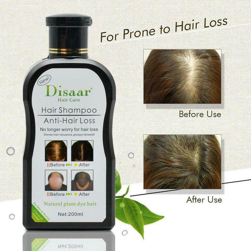 Shampooing naturel Anti-perte de cheveux, 200ml, sérum de traitement pour cheveux plus épais, tonique, nettoie le cuir chevelu, Essence de réparation des dommages