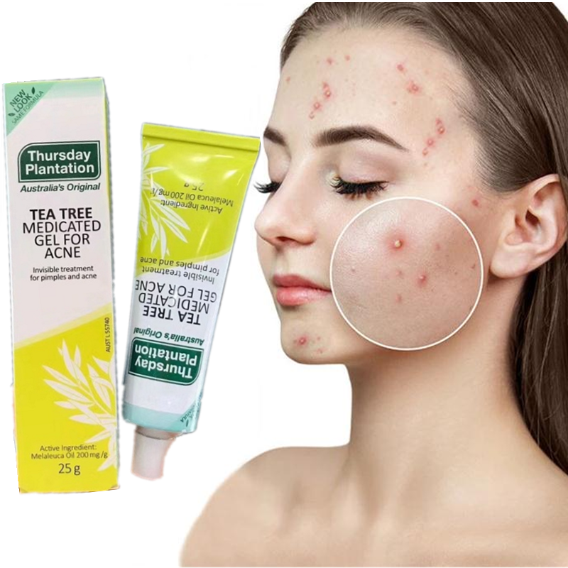 A nova versão de austrália quinta-feira acne gel efetivamente remove acne reduz manchas de acne controles óleo encolhe poros clareia