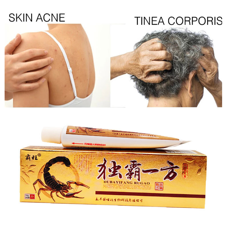 Skin Care ผลิตภัณฑ์ที่มีประสิทธิภาพ Anti-Itch สะเก็ดเงิน Antibacterial ครีมโรคผิวหนัง Eczematoid ครีม15G