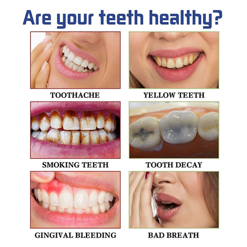 Flor semana dentes branqueamento mousse, Remove o odor oral, Cálculo dental, Mancha de dente, Reparação de creme dental branco, Cuidados dentários gengivais