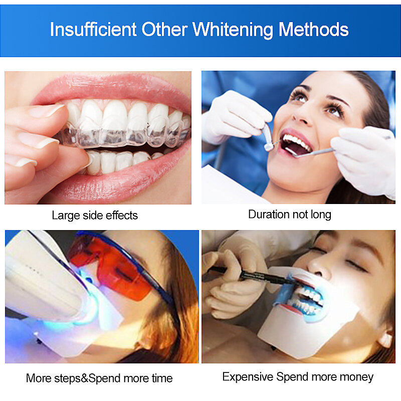 SOOMIIG ฟัน Plaque Removal Whitening Toothpaste ยาสีฟันไข่มุกผงฟันทำความสะอาดช่องปากทันตกรรม Agent ทันตกรรม