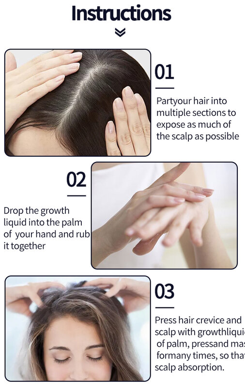 Fast Hair Growth Serum Effective Treatment For Bald Genetic Hair Loss Postpartum Hair Loss Seborrheic Alopecia Bushy Hairline