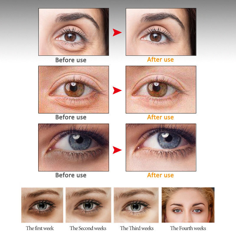 إزالة العين حقيبة كريم عين مكافحة الظلام دائرة الببتيد العين مدلك المضادة للتجاعيد تمييع الخطوط الدقيقة التجاعيد ترطيب العين الرعاية 20 مللي