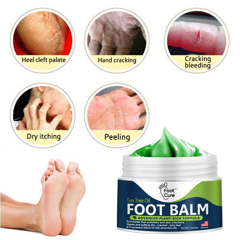 Anti-Drying Crack ครีมส้นเท้าแตกซ่อมครีม Dead Skin Hand Feet Care มือและเท้าผิว care Foot Peel 15/50G