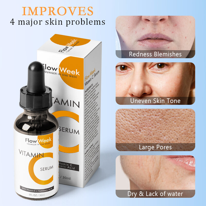 Flow Woche Vitamin C Gesicht Serum White ning Anti Dark Spot Anti-Aging serum aufhellen des Serum für dunkle Flecken sogar Hautton