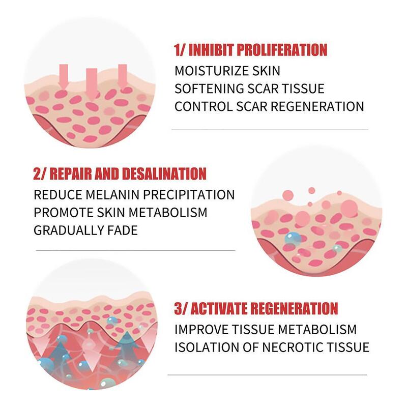 Blizny potrądzikowe krem do depilacji naprawa spalić blizny chirurgiczne rozstępy promowanie regeneracji komórek naprawa leczenie pielęgnacja ciała skóry 20g