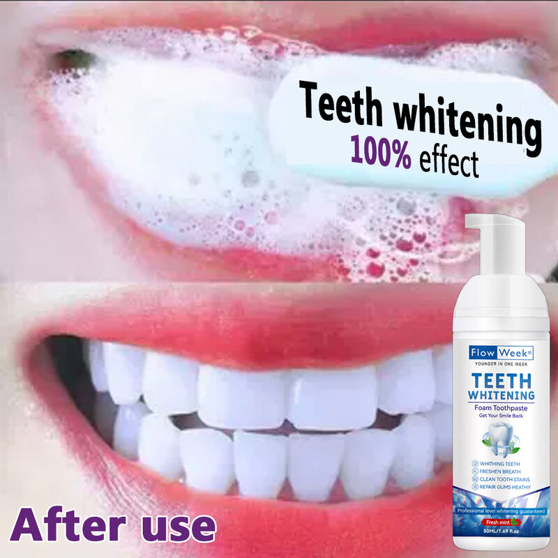 FlowWeek 치아 미백 무스, 구강 냄새 제거, 치석 얼룩 제거, 하얀 치아 치약, 잇몸 치과 치료