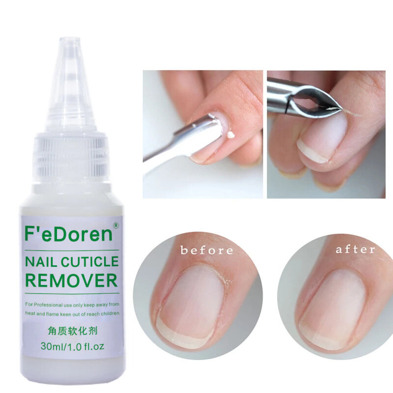 30ml Nail Cuticle Remover ammorbidente liquido esfoliante trattamento olio per cuticole Manicure ammorbidire la pelle morta tutto per Manicure cura delle unghie