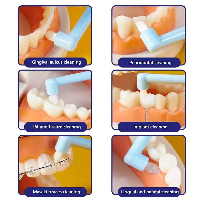 교정 치간 브러시 부드러운 치아 청소 부드러운 치아 청소 칫솔 치실 치과 칫솔 구강 관리 도구