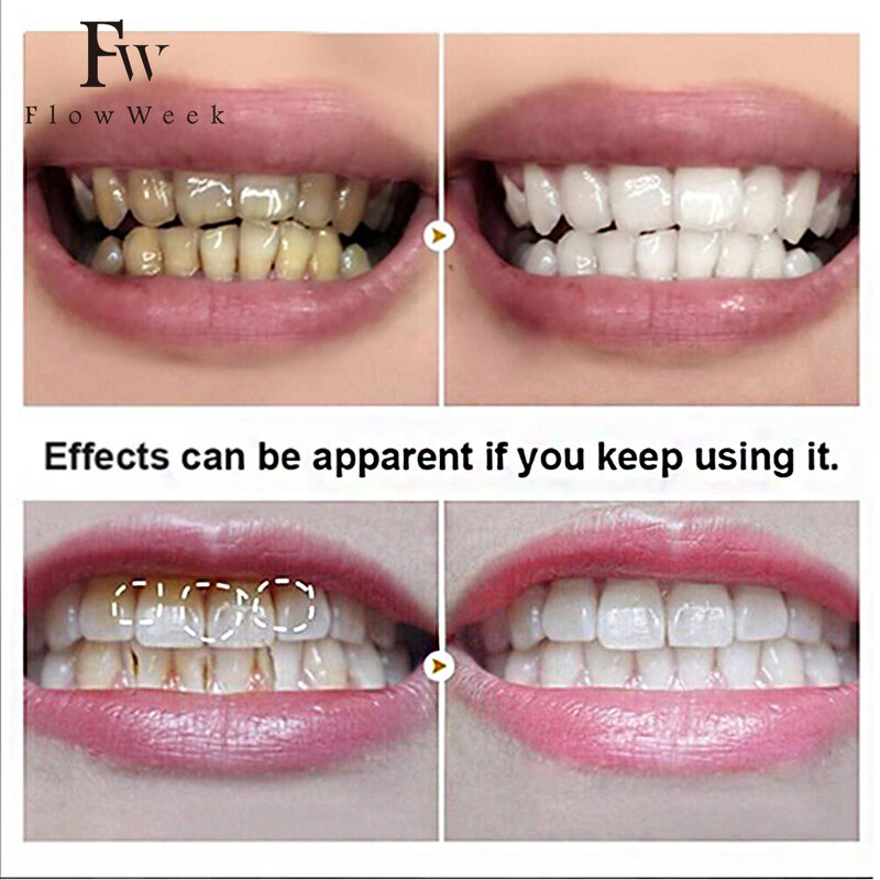Probioti Tanden Bleken Poedertanden Verhelderen Mondhygiëne Essentie Verwijderen Tandplak Tandpasta Tandenborstel Kit Verzorging