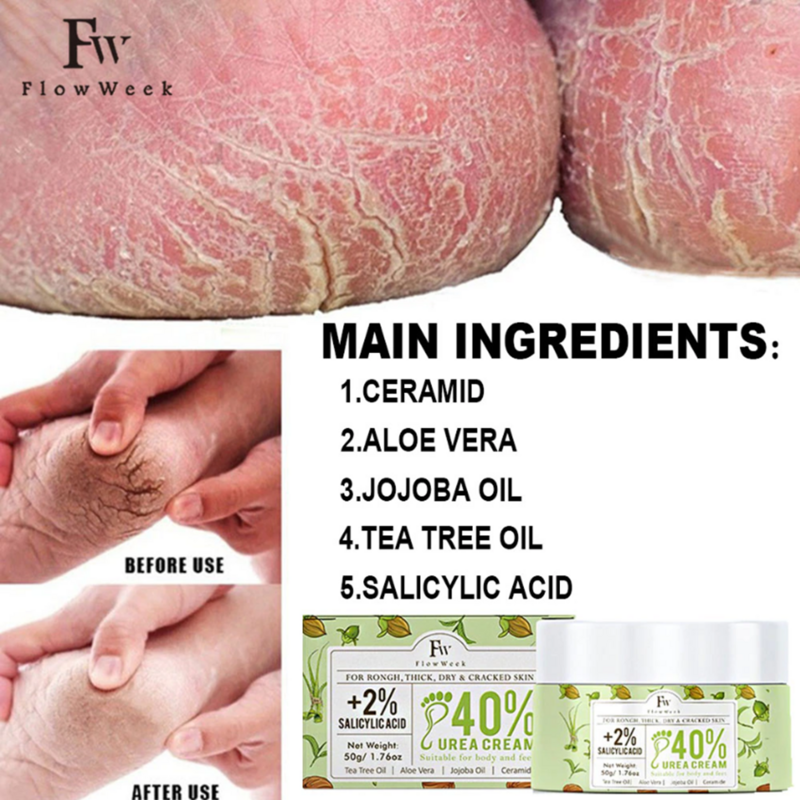 Flow Week Vitamin E Urea Cream Skin Care Cream Urea 40% Foot Cream Callus Remover Foot Moisturizer Corn Callus Dead Skin Remover