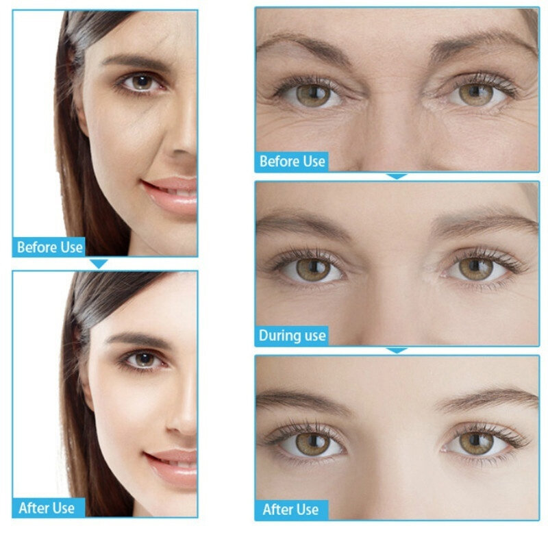 คาเฟอีน Solution 5% + EGCG Eye Essence ธรรมดากำจัดถุงตา Eye Dark Circle Lightening Fine Line Eye Serum Care