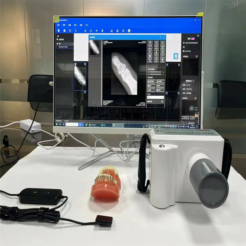 Apparecchiature odontoiatriche schermo LCD macchina a raggi X digitale dentale macchina a raggi X portatile con sensore dimensioni 2