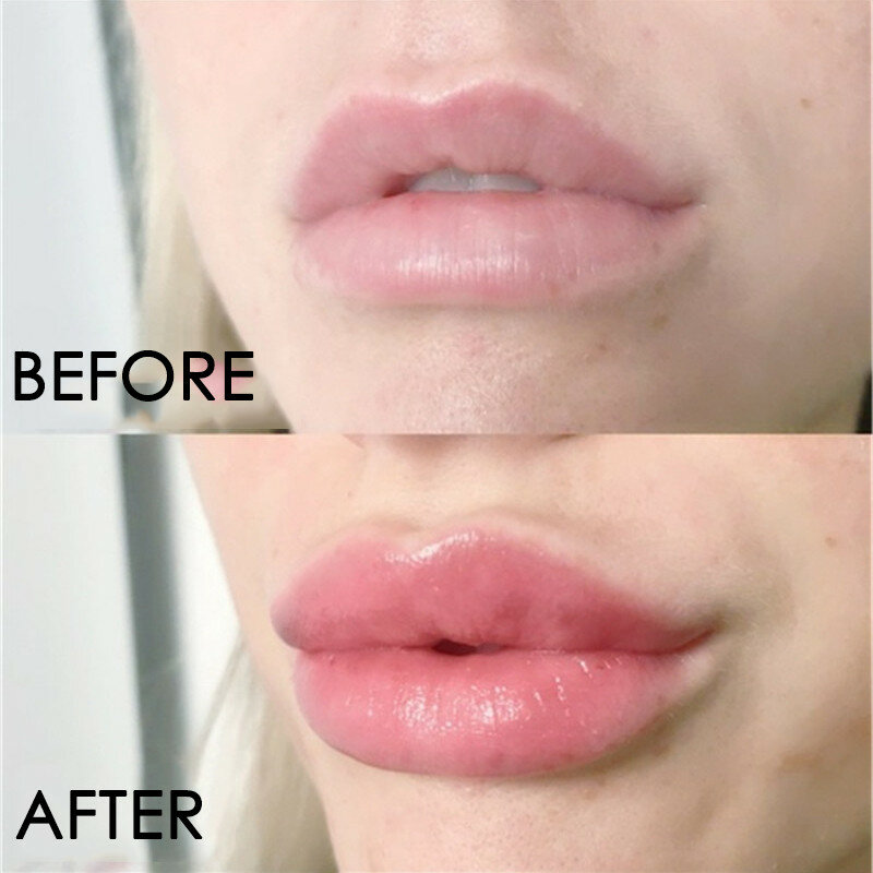 Instant Volumising Lip Öl Augmentation Serum Praller Lip Maximizer LipGloss Reduzieren Lip Feine Linien Feuchtigkeitscreme Lip Enhancer Balsam
